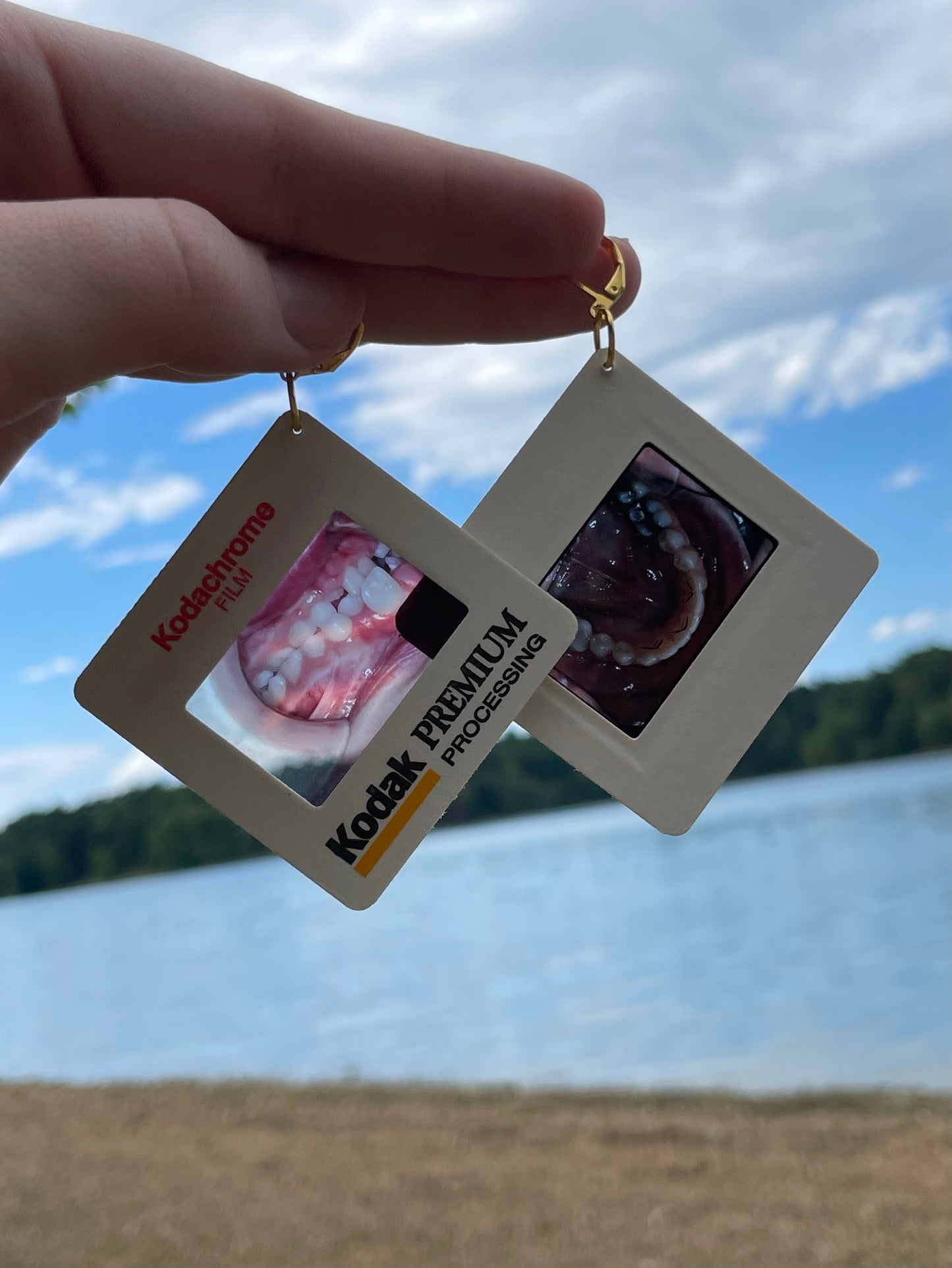 1990's Dental Images Earrings