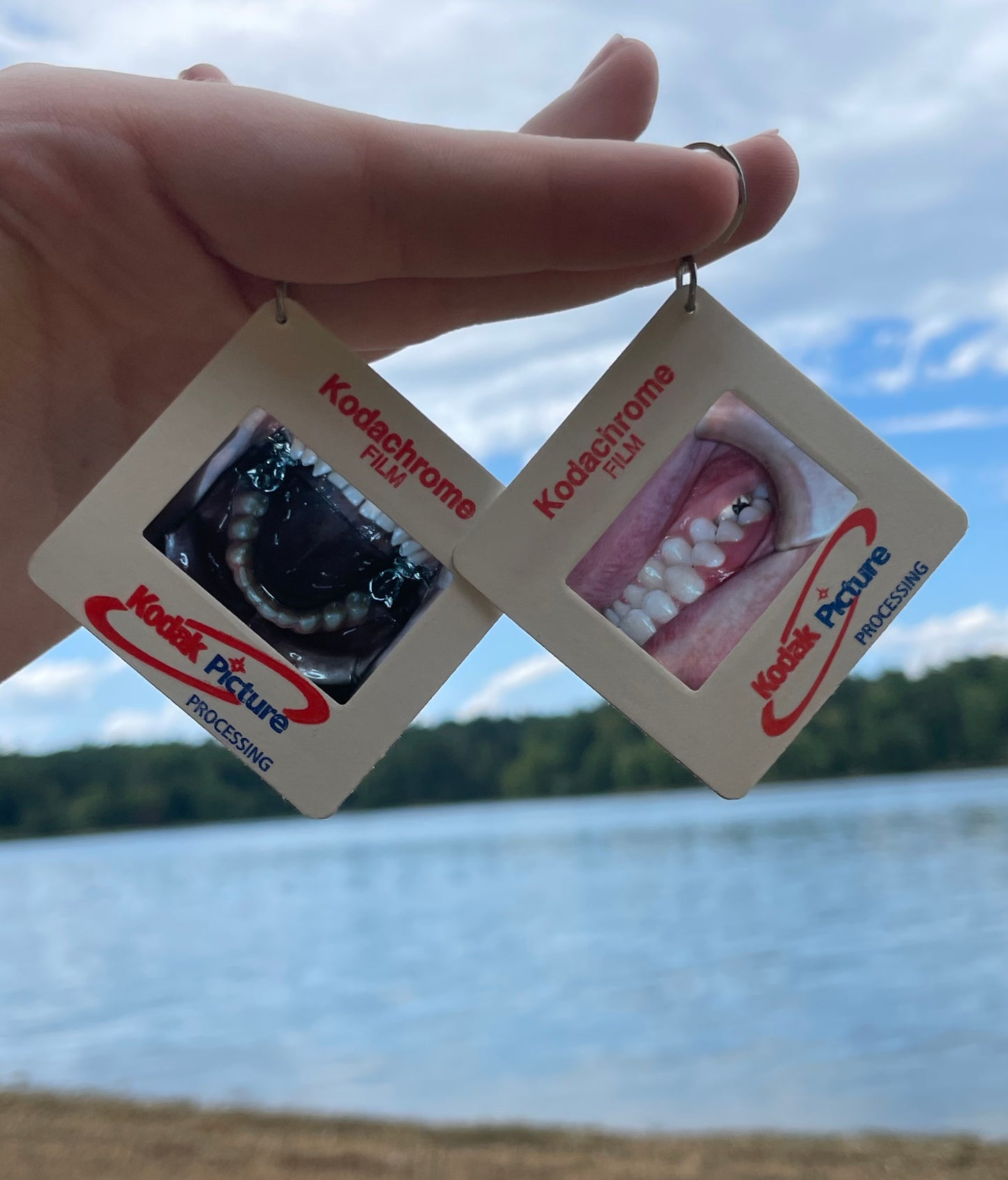 1990's Dental Images Earrings