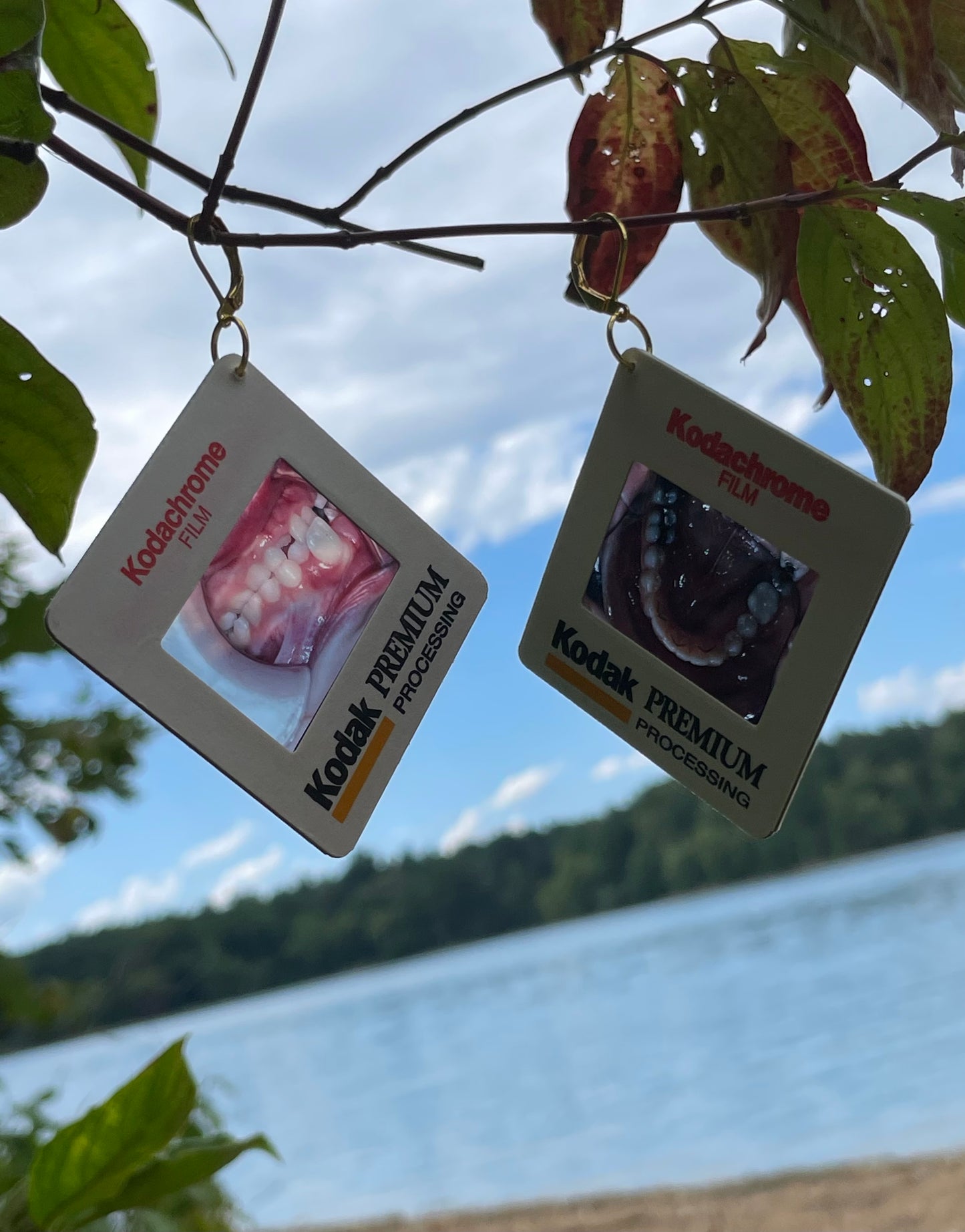 1990's Dental Images Earrings