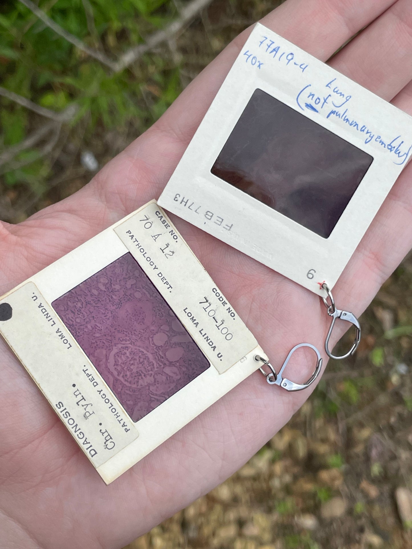 1980's Medical Images Earrings